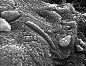Microbial worm on Mars?